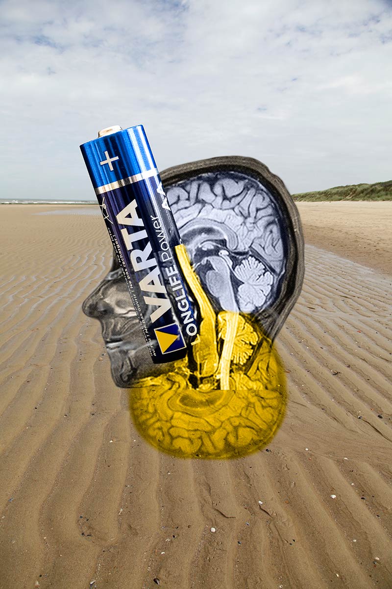 A colorized MRI image of the head and brain is fused to a battery. The object floats in a beach landscape.